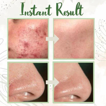 GREEN TEA DEEP CLEANSE MASK